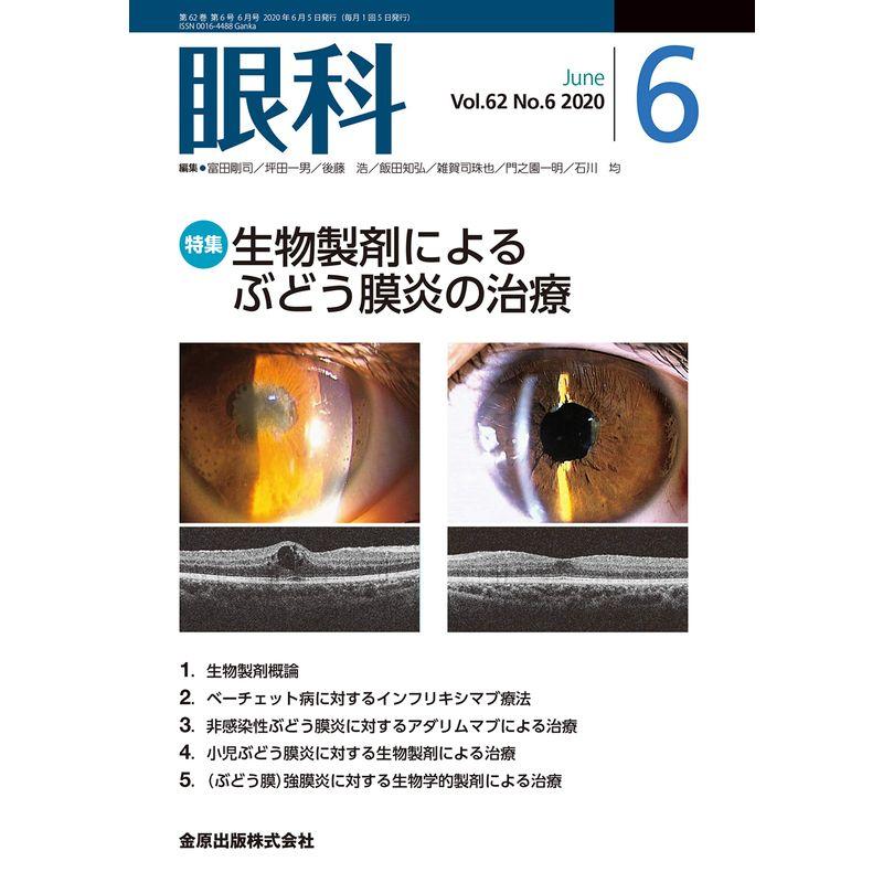 眼科 2020年 06 月号 雑誌