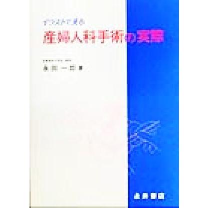 イラストで見る産婦人科手術の実際／永田一郎(著者)