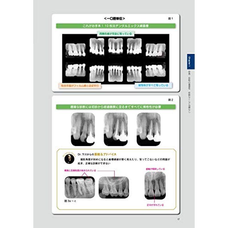 歯科臨床の知恵と技 結果にこだわる 「下川臨床」テクニックあの手この手