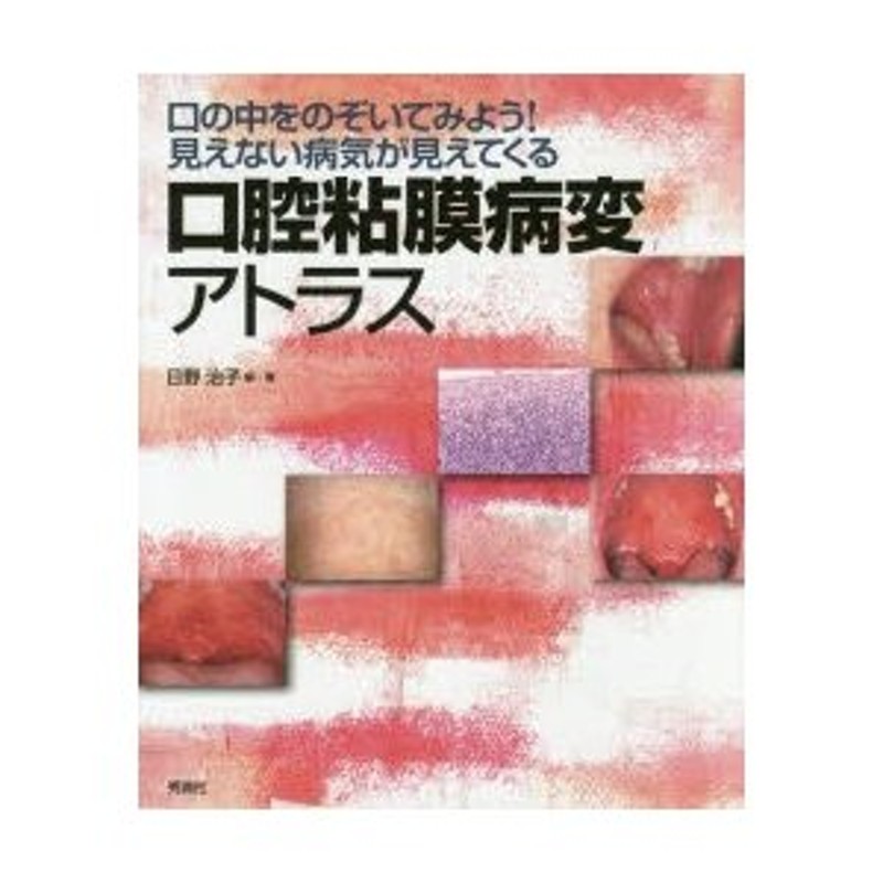 口腔粘膜病変アトラス 口の中をのぞいてみよう!見えない病気が見えて