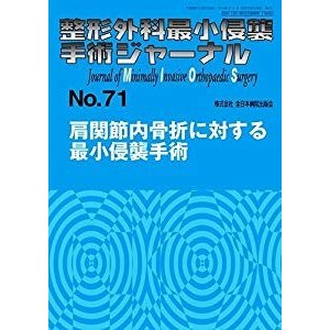 肩関節内骨折に対する最小侵襲手術 (整形外科最小侵襲手術ジャーナル)