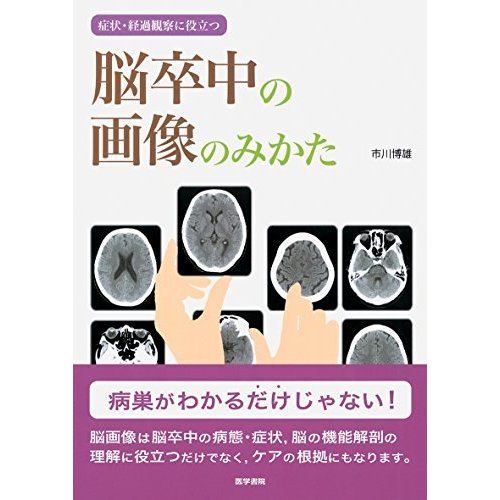 症状・経過観察に役立つ 脳卒中の画像のみかた