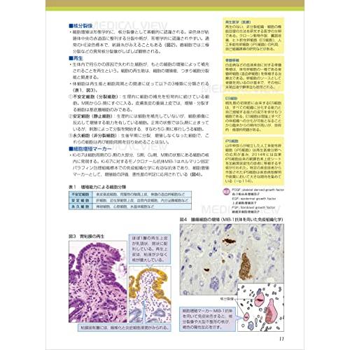 病理学 (カラーイラストで学ぶ 集中講義)