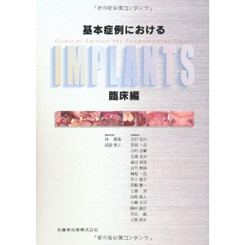 基本症例におけるIMPLANTS 臨床編