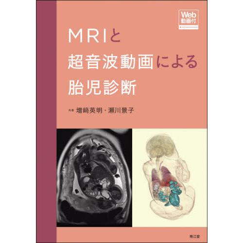 MRIと超音波動画による胎児診断 Web動画付 増崎英明 瀬川景子