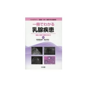 一冊でわかる乳腺疾患   何森亜由美  〔本〕