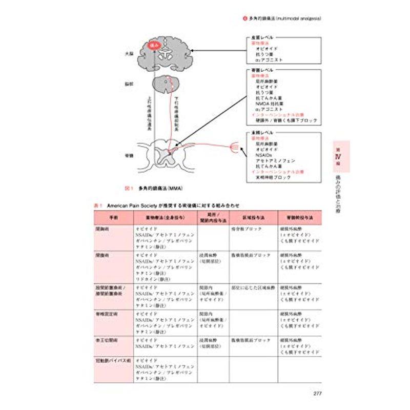 疼痛医学