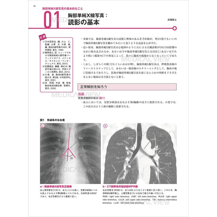 全ての 裁断済み 小児画像診断の勘ドコロNEO 健康・医学 