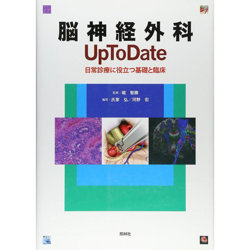 脳神経外科 Up To Date: 日常診療に役立つ基礎と臨床