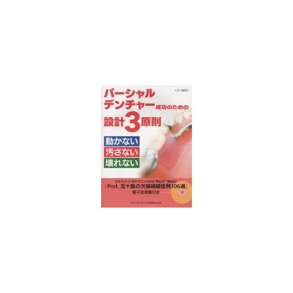 パーシャルデンチャー成功のための設計3原則 動かない汚さない壊れない