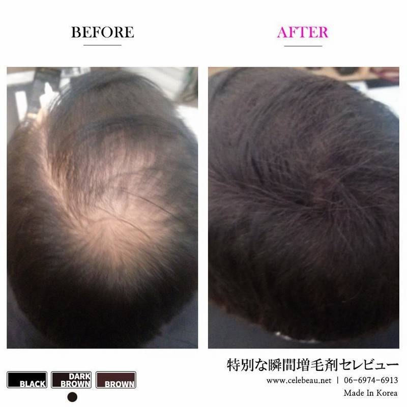 噴霧式ボトルタイプ 薄毛増毛ふりかけパウダー禿げ白髪隠し