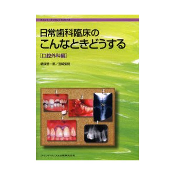 日常歯科臨床のこんなときどうする 口腔外科編