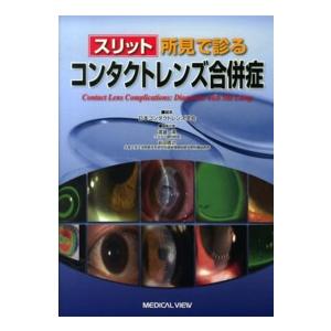 スリット所見で診るコンタクトレンズ合併症