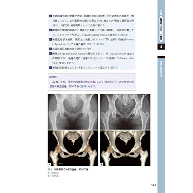 整形外科医のための 股関節のスポーツ診療のすべて