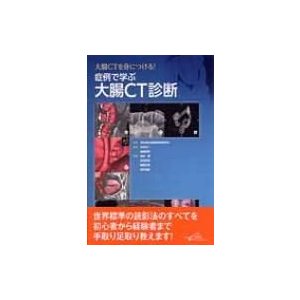 大腸CTを身につける!症例で学ぶ大腸CT診断   永田浩一  〔本〕