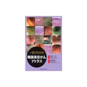 一目でわかる咽頭表在がんアトラス