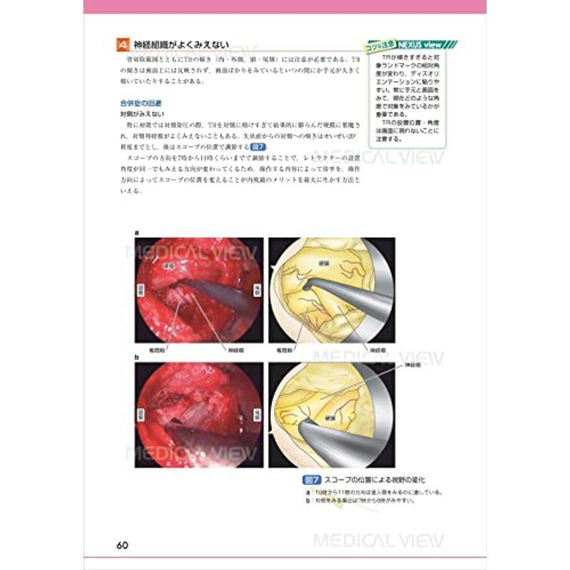 脳神経外科医のための脊椎外科 必須手技と合併症回避のコツ - 医学 