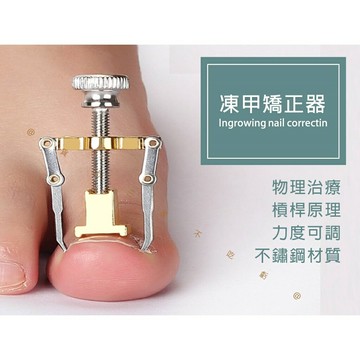 @貨比三家不吃虧@凍甲矯正器 糾正指甲 嵌甲 嵌甲矯正器 腳趾甲矯正器 足部保養 鷹嘴鉗 指甲剪工具 凍甲嵌甲矯正 腳趾