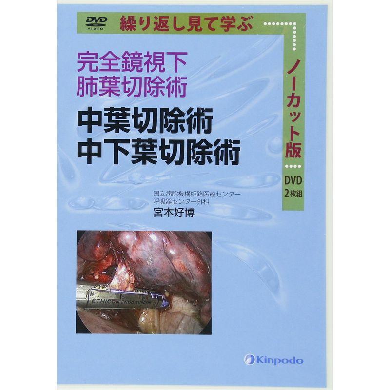 完全鏡視下肺葉切除術 中葉切除術 中下葉切除術