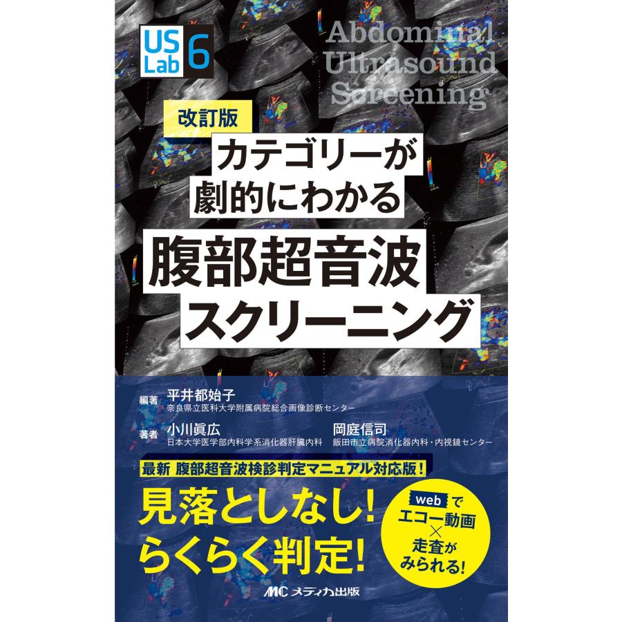 カテゴリーが劇的にわかる腹部超音波スクリーニング webでエコー動画x走査がみられる 見落としなし らくらく判定