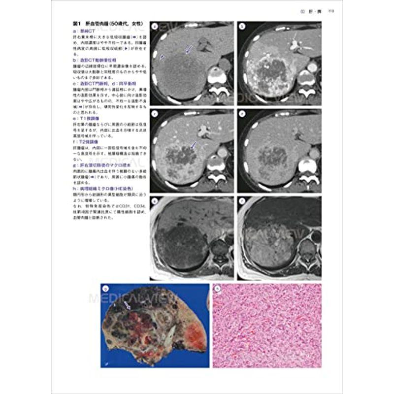 消化器 画像診断の勘ドコロNEO