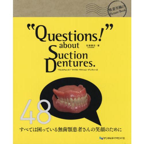 Questions about Suction Dentures.