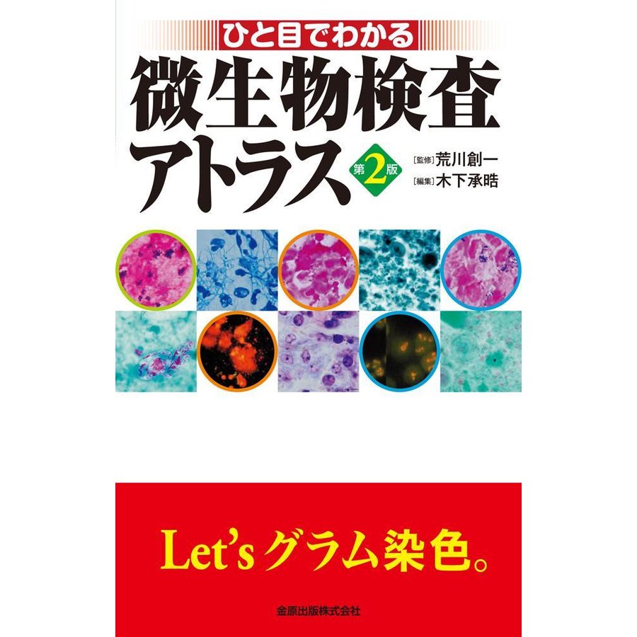 ひと目でわかる微生物検査アトラス