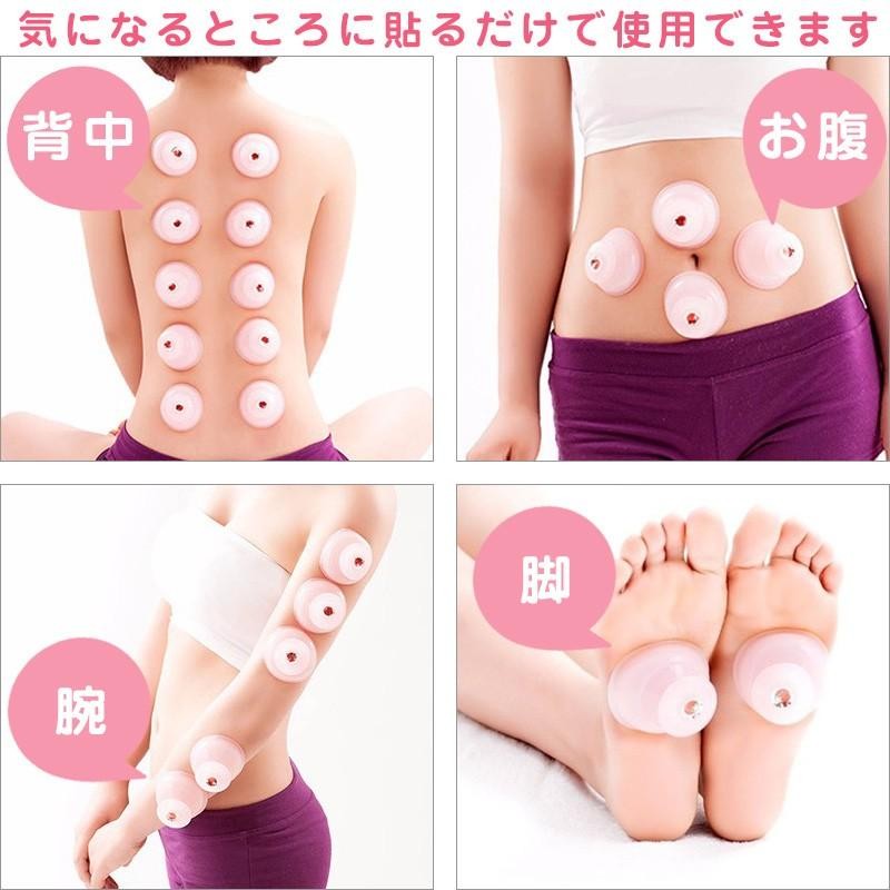 シリコン カッピング 吸玉 計20個セット 吸い玉 吸角 ツボ刺激