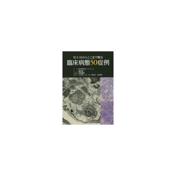 腎生検からここまで解る臨床病態50症例