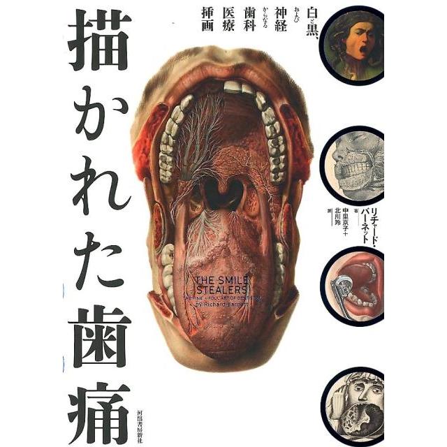 描かれた歯痛 白と黒,および神経からなる歯科医療挿画 リチャード・バーネット 中里京子 北川玲