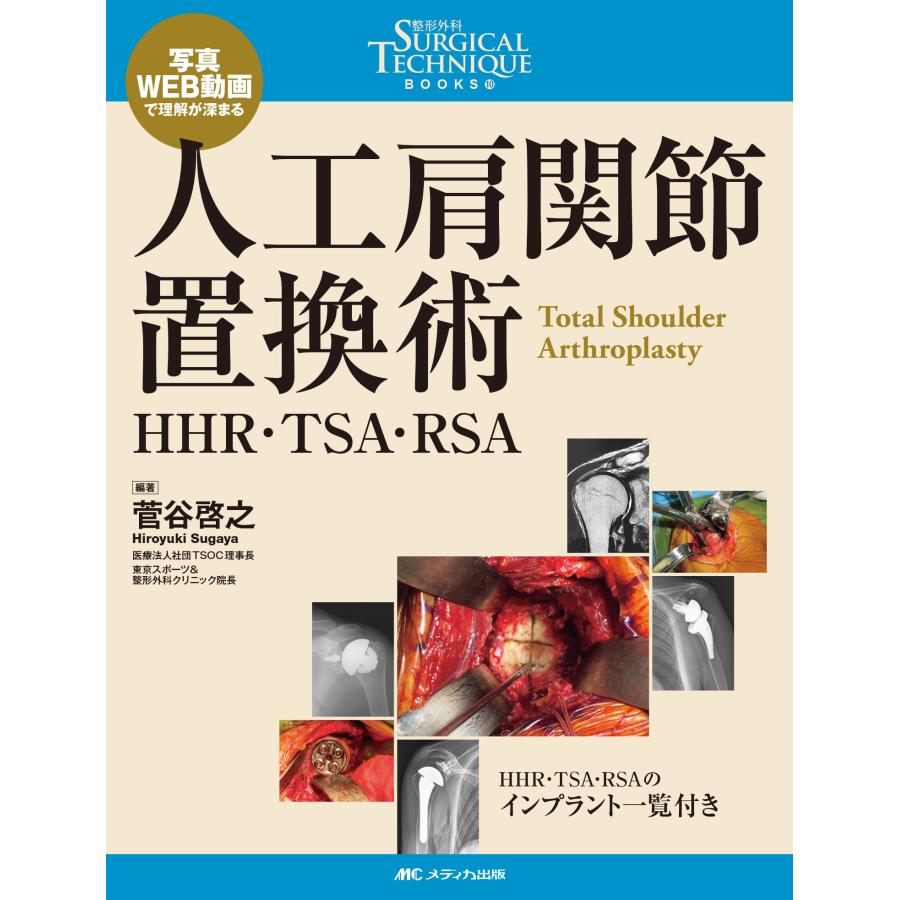 人工肩関節置換術 HHR・TSA・RSA 写真・WEB動画で理解が深まる