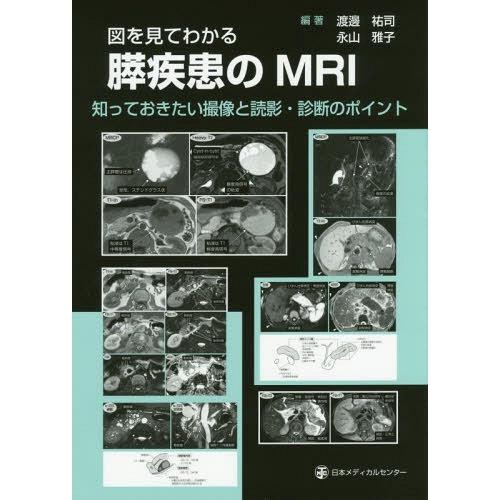 翌日発送・図を見てわかる膵疾患のMRI 渡邊祐司