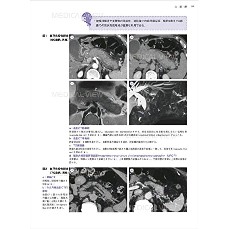 消化器 画像診断の勘ドコロNEO