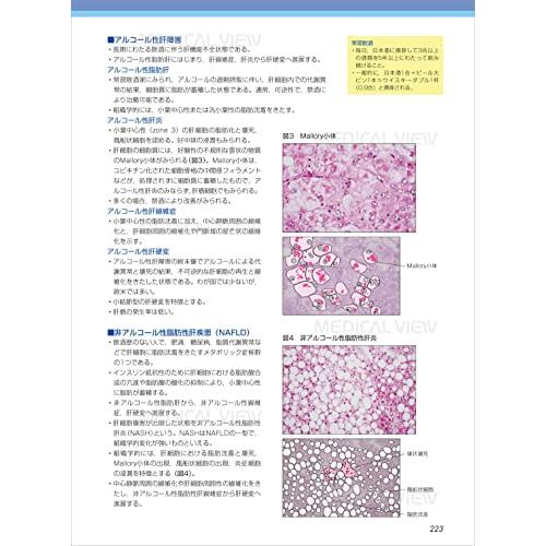 病理学 (カラーイラストで学ぶ 集中講義)