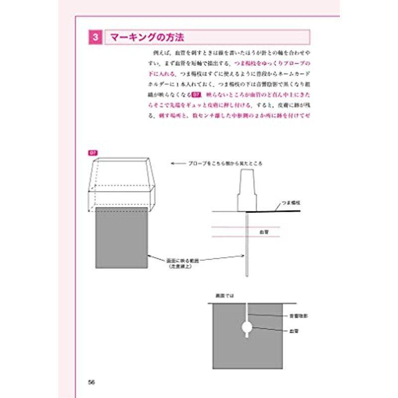 一気に上級者になるための麻酔科医のテクニック 第3版