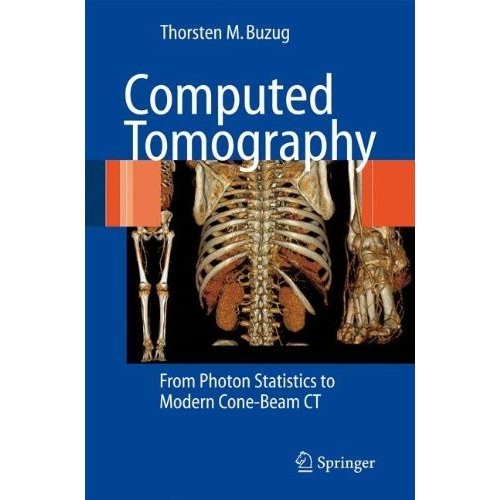 Computed Tomography: From Photon Statistics to Modern Cone-Beam CT