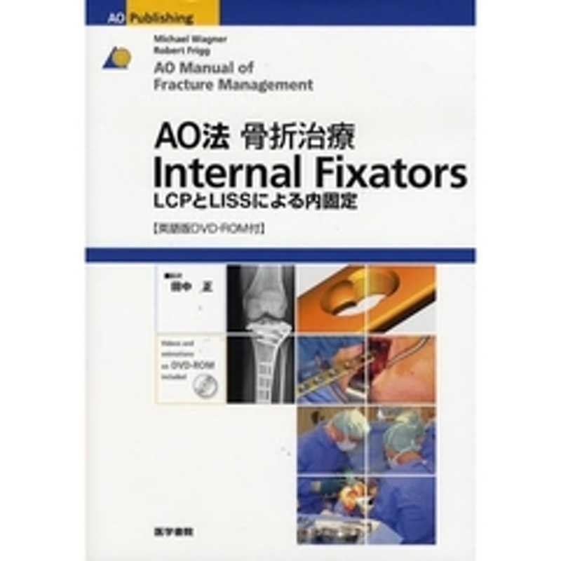 ＡＯ法骨折治療Ｉｎｔｅｒｎａｌ Ｆｉｘａｔｏｒｓ ＬＣＰとＬＩＳＳ