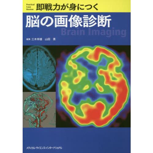 即戦力が身につく脳の画像診断