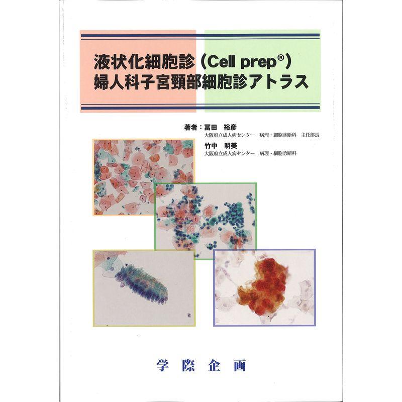 液状化細胞診(Cellprep)婦人科子宮頚部細胞診アトラス