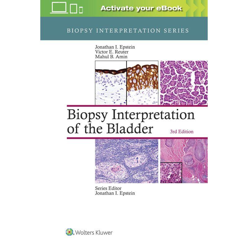 Biopsy Interpretation of the Bladder (Biopsy Interpretation Series)