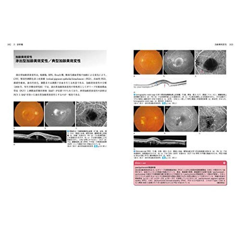 黄斑部 (眼科診療ビジュアルラーニング)
