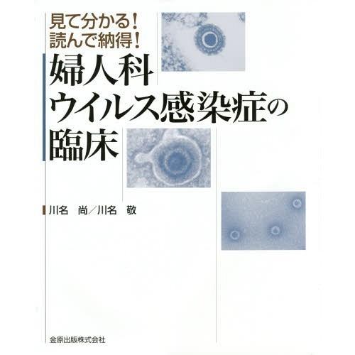 婦人科ウイルス感染症の臨床 見て分かる 読んで納得