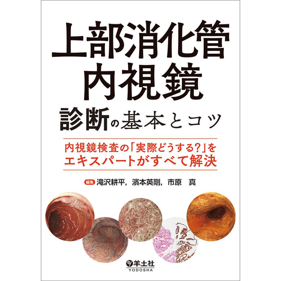 上部消化管内視鏡診断の基本とコツ 内視鏡検査の 実際どうする をエキスパートがすべて解決