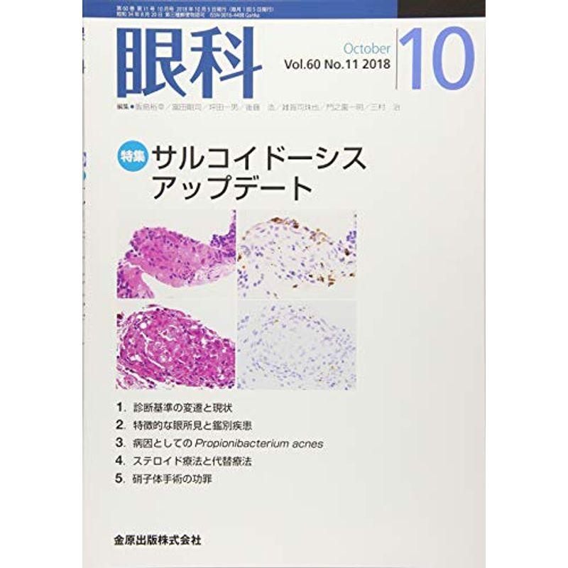 眼科 2018年 10 月号 雑誌