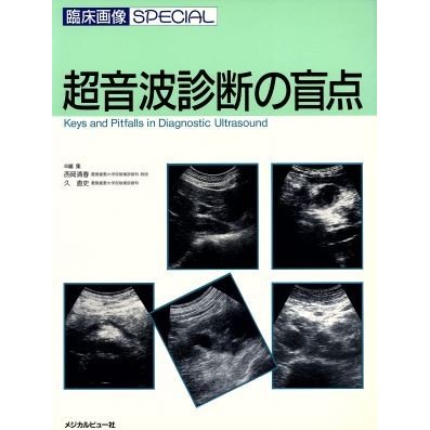 超音波診断の盲点／西岡清春(編者),久直史(編者)