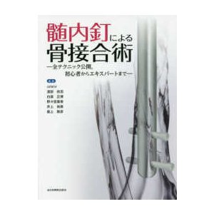 髄内釘による骨接合術-全テクニック公開、初心者からエキスパートまで