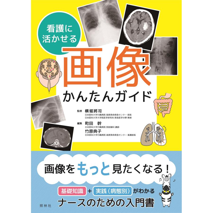 看護に活かせる画像かんたんガイド 横堀將司 監修 町田幹 編集 竹原典子