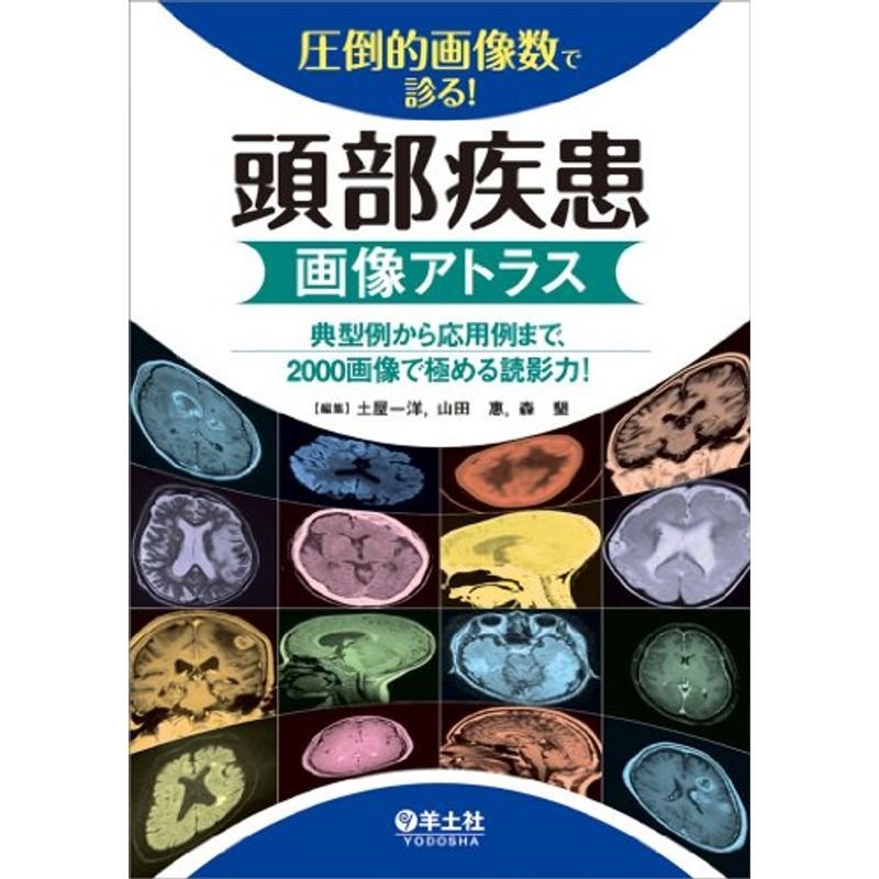 圧倒的画像数で診る　頭部疾患画像アトラス〜典型例から応用例まで、2000画像で極める読影力　LINEショッピング