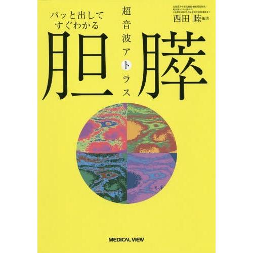 パッと出してすぐわかる胆・膵超音波アトラス 西田睦