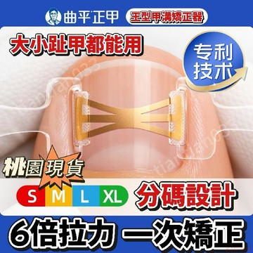桃園出貨✨曲平醫生 正甲鋼片甲溝嵌甲指甲矯正器正甲貼片腳趾甲蓋扎肉 卷甲矯正器 指甲貼片 嵌甲貼片 捲甲 凍甲矯正器